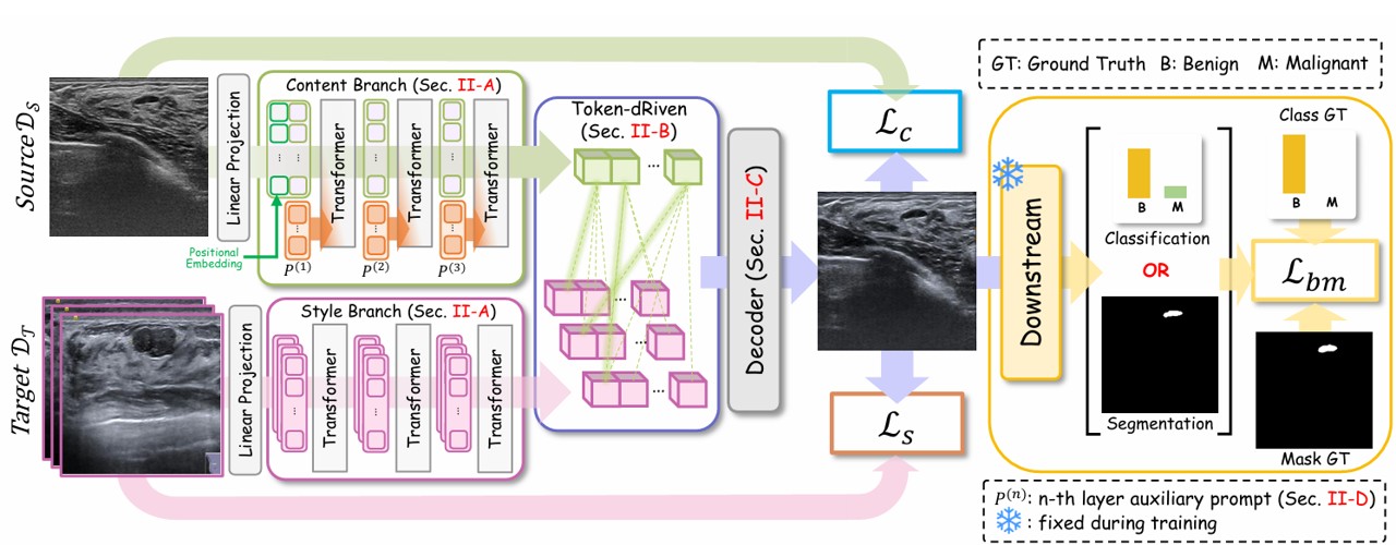 TRUST: Token‑dRiven Ultrasound Style Transfer for Cross‑Device Adaptation